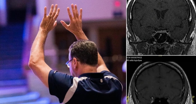 O tumor desapareceu do cérebro do homem no segundo exame. (Foto: Imagem ilustrativa/Unsplash/Jesus Loves Austin/Instagram/Shakersplaces).