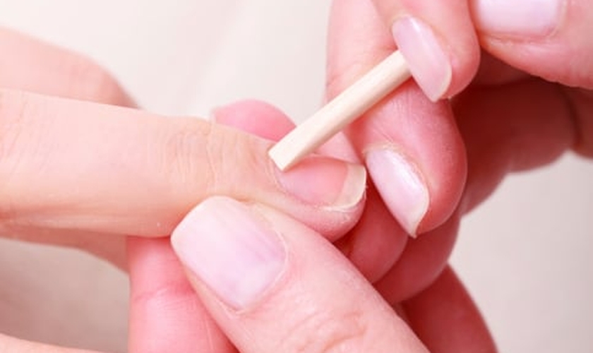 unhas quebradiças