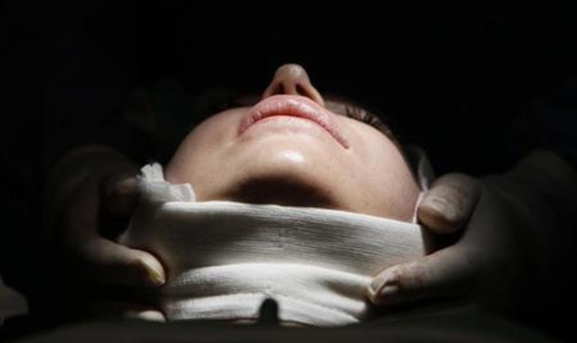 Mulher durante cirurgia plástica em uma clínica de Budapeste, Hungria, em março de 2012.
