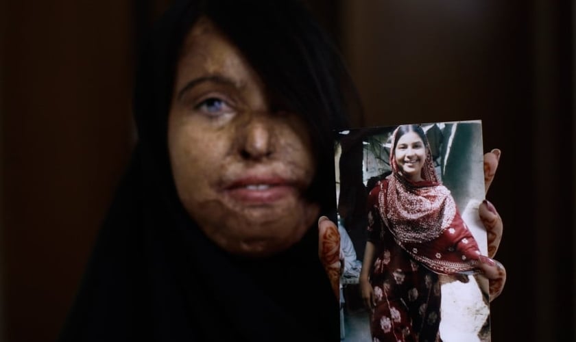 Naila Farhat, de 22 anos, é uma paquistanesa sobrevivente a um ataque com ácido. A jovem segura uma foto que mostra seu rosto antes do ataque. (Foto: AP)