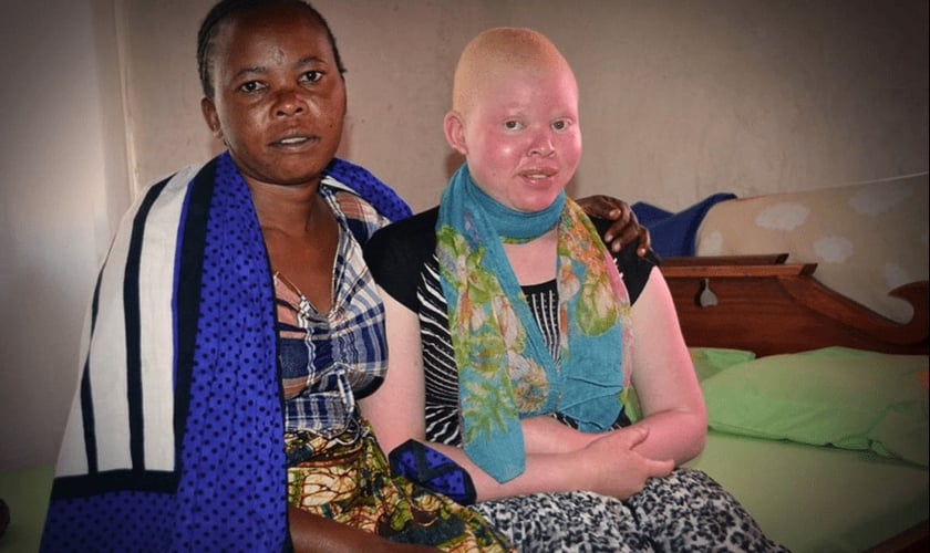 Flora e sua filha Grace, que nasceu com albinismo. (Foto: Reprodução/Faithit)