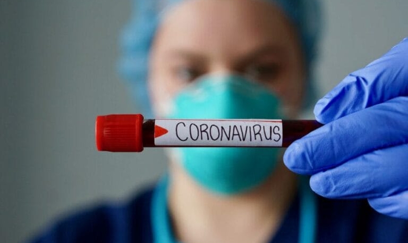 Pesquisas sobre o coronavírus seguem intensas para cientistas descobrirem mais sobre a doença. (Foto: Divulgação)