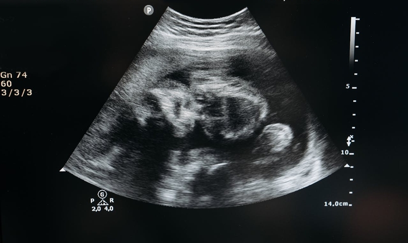 Mudança no Código Civil reconhece personalidade legal ao feto. (Foto: Pavel Danilyuk / Pexels)