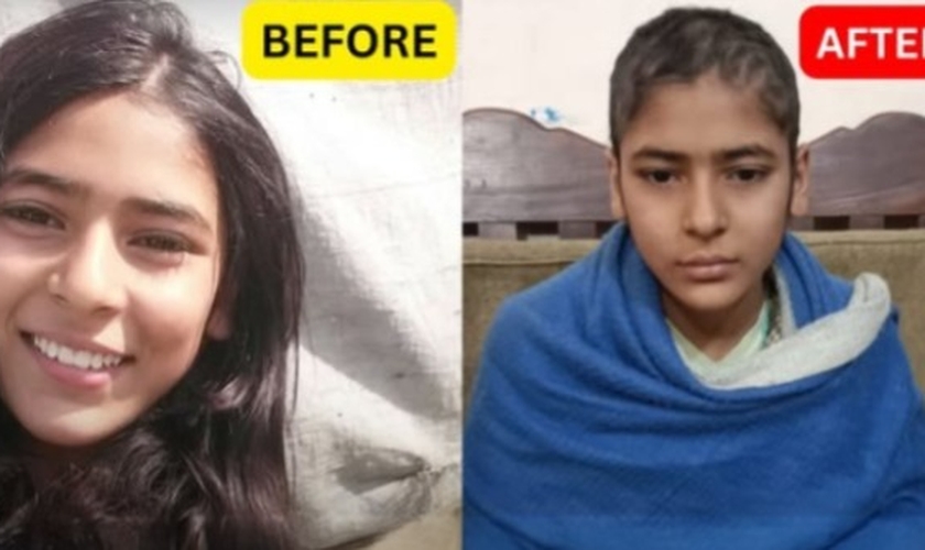 Zarnab Noor antes e depois de ser torturada por seus empregadores muçulmanos. (Foto: Samaritan’s Fellowship Foundation).