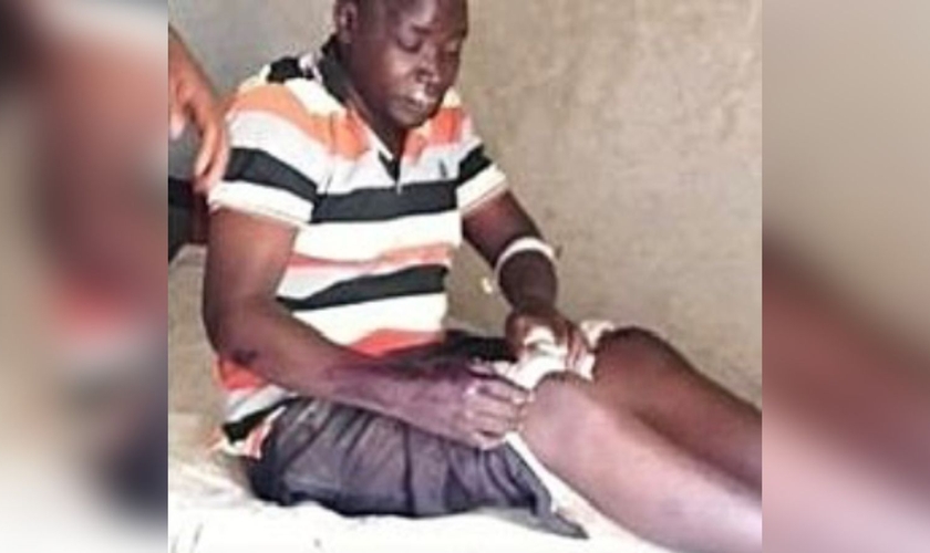 Um dos pastores agredidos pelos muçulmanos. (Foto: Reprodução/Morning Star News)