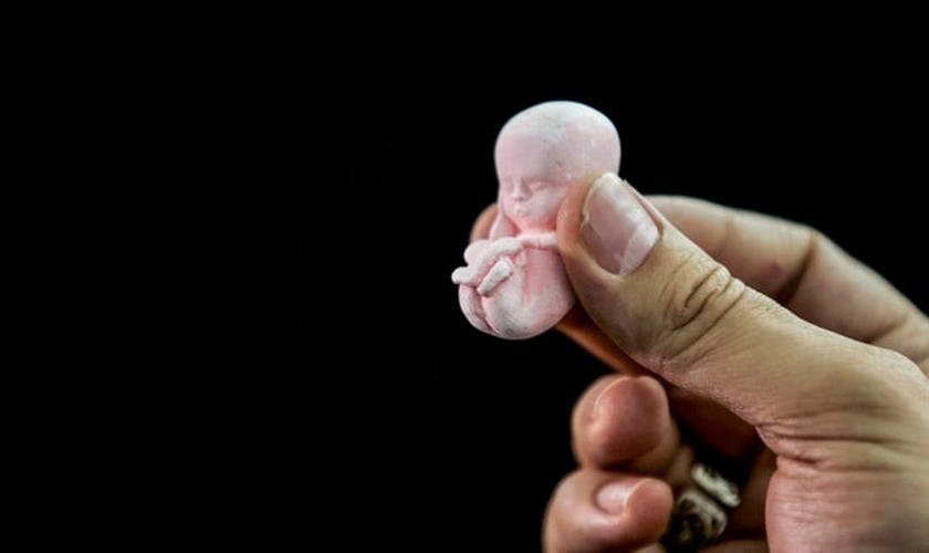 Maioria dos brasileiros são contra qualquer tipo de aborto e apoiam sua proibição. (Foto: Bruno Domingos/Reuters)