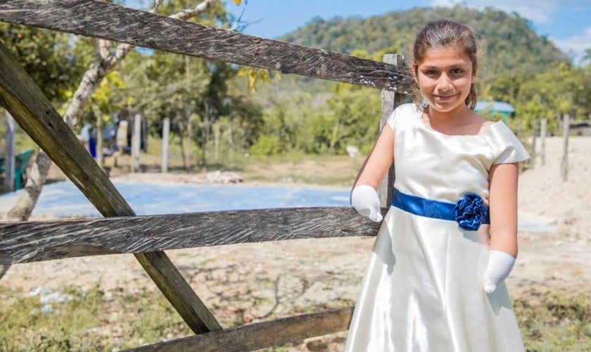 Cleidy é exemplo de superação em sua comunidade, por ser uma jovem escritora premiada, mesmo tendo nascido sem as duas mãos. (Foto: Compassion)