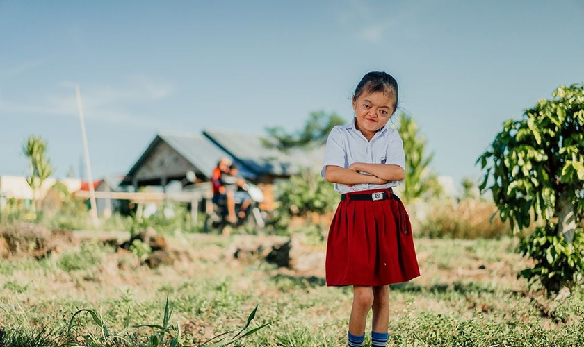 Karunia nasceu com Síndrome de Apert, mas não deixou de se sentir confiante. (Foto: Compassion International)