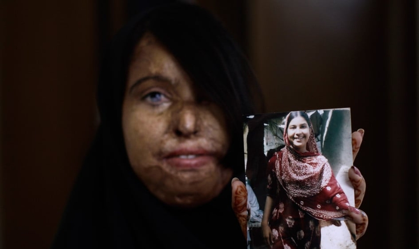Naila Farhat, de 22 anos, é uma paquistanesa sobrevivente a um ataque com ácido. A jovem segura uma foto que mostra seu rosto antes do ataque. (Foto: AP)