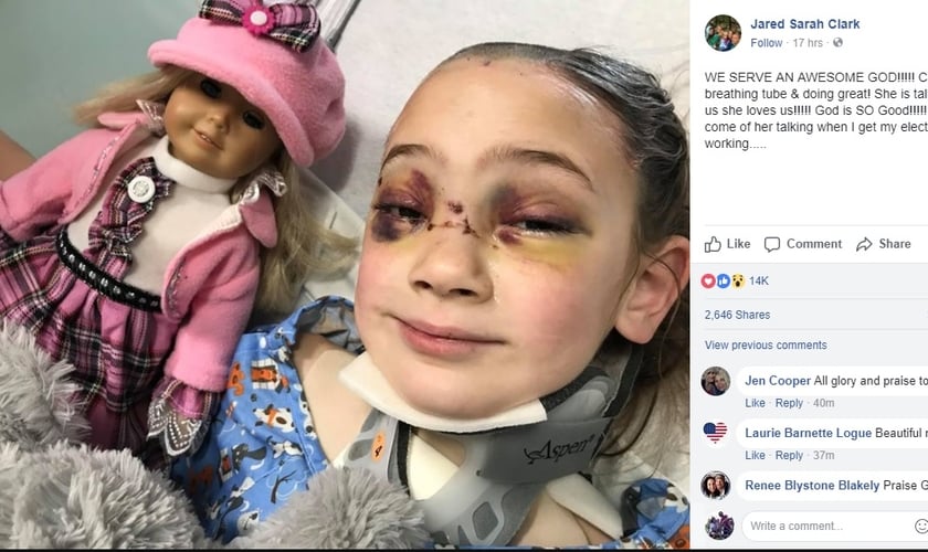 Uma foto da garota já acordada foi publicada pelo pai no hospital. (Foto: Facebook)