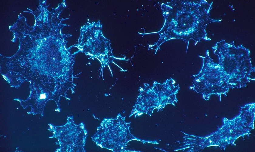 Cientistas acreditam que mortes por câncer serão eliminadas até 2050