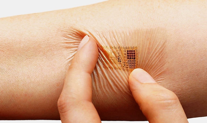 Imagem sugere como seria a possível implantação de chip na pele humana. (Foto: EI Confidencial)