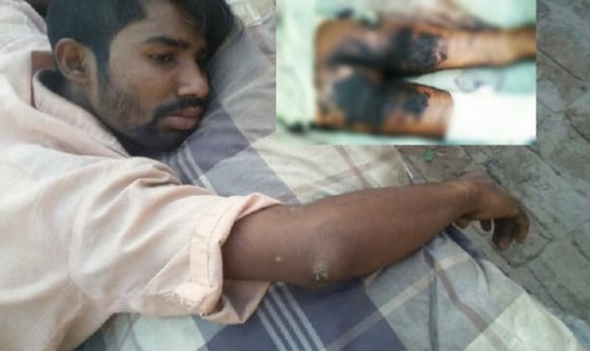 Ansar diz que ainda está traumatizado pelo ataque. “Estou com muito medo de sair de casa". (Foto: Reprodução).