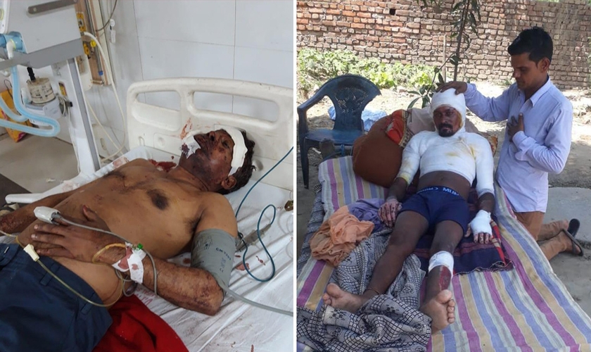 Cristãos espancado e pastor que teve o corpo incendiado recebe oração de um cristão, irmão do pastor Rashphal. (Foto: Divulgação/Rashphal.)