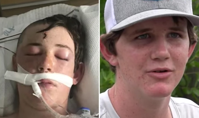 : Caleb quando estava em como e hoje, recuperado. (Foto: Reprodução/WTSP)