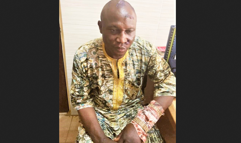Pastores muçulmanos Fulani feriram o pastor batista Elisha Noma enquanto o mantinham em cativeiro. (Foto: Reprodução/Morning Star News)