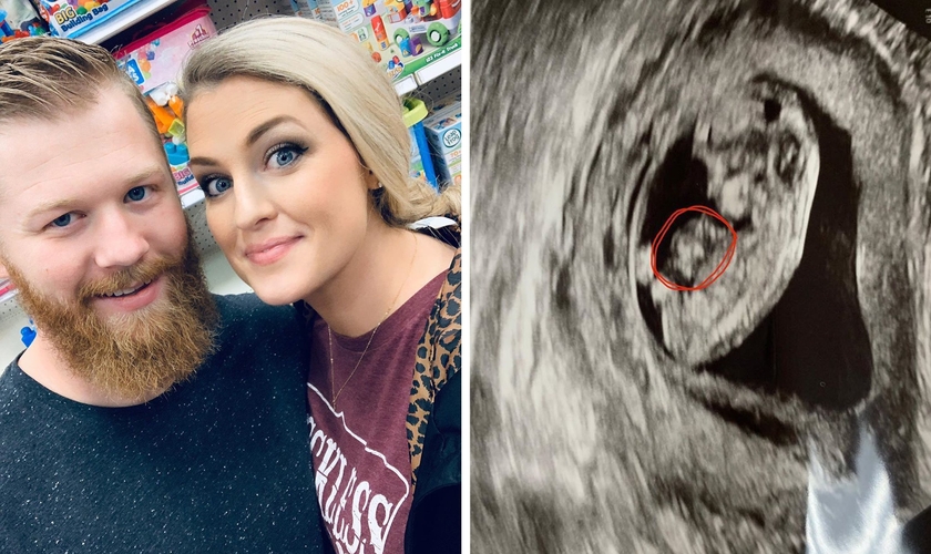 Rachel e Anthony Jenkins receberam o diagnóstico de que um dos trigêmeos estava com um raro defeito congênito. (Foto: Guiame/Instagram/Rachel Jenkins)