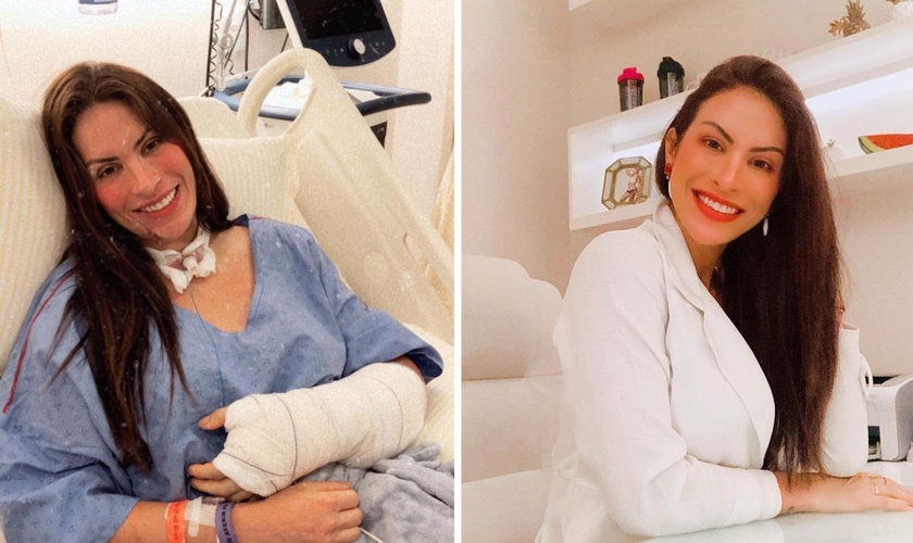 A médica Dieynne Saugo sai da UTI após ser picada por jararaca. (Foto: Reprodução / Instagram)