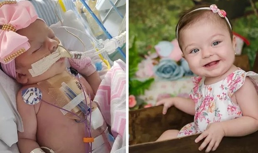 Ayla durante internação, e hoje, com 1 aninho. (Foto: Reprodução / Arquivo pessoal)