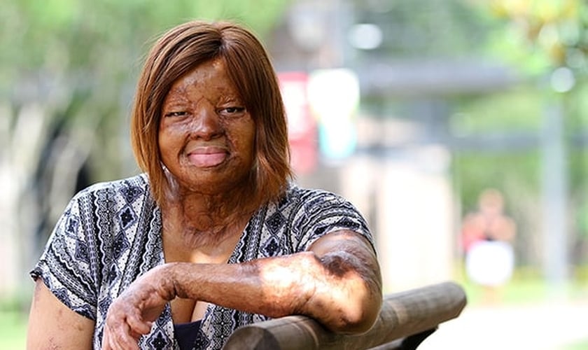 Kechi Okwuchi sobreviveu a uma queda de avião em 2005 na Nigéria. (Foto: Daily Word)