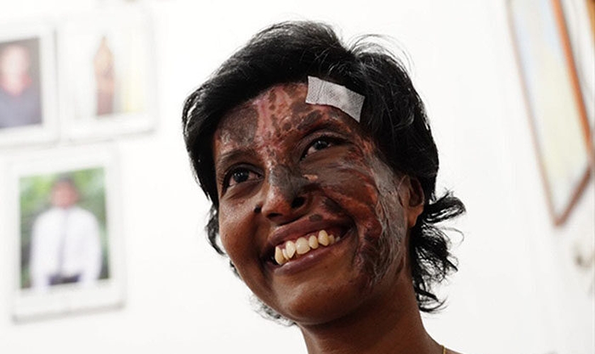 A cristã Rebekah com marcas da explosão feita por terroristas em uma igreja no Domingo de Páscoa. (Foto: Reprodução / UGCN)