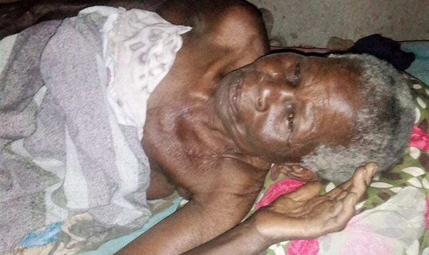 Após o ataque, a idosa recebeu atendimento médico por lesões nas costas, costela e tórax e ainda continua hospitalizada. (Foto: Morning Star News).