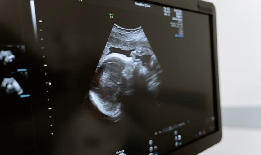 Ultrassom de feto. (Foto: Reprodução / Pexels)
