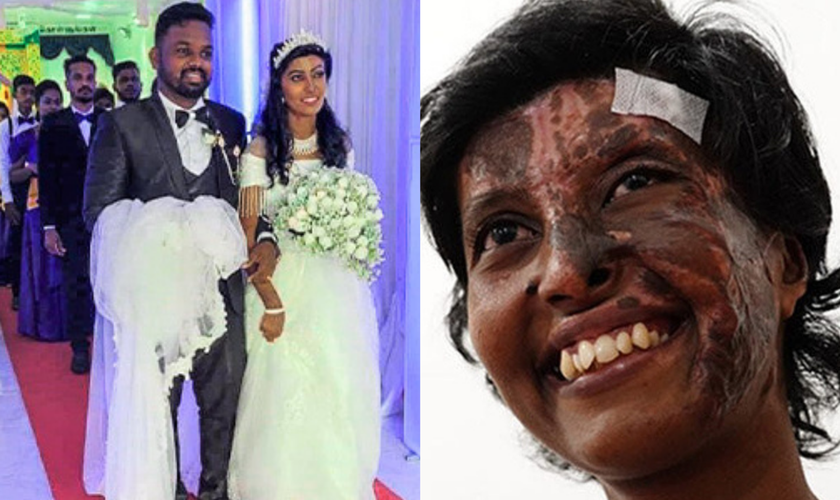 Rebekah em seu casamento com Kaushik; ao lado, após sofrer queimaduras durante ataque em 2019. (Foto: Reprodução / Open Doors)
