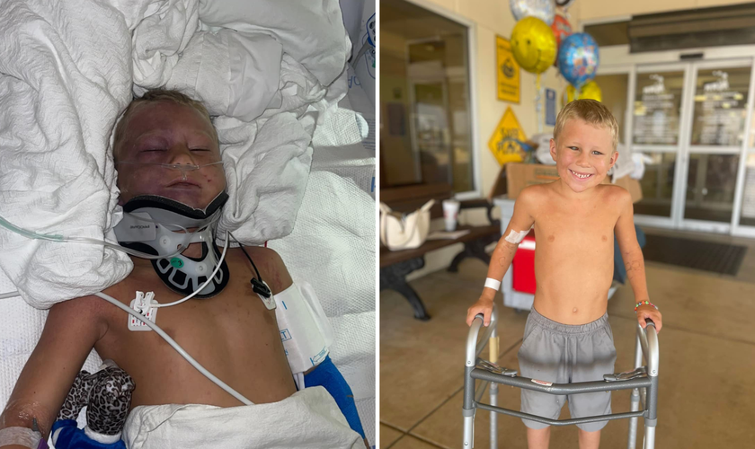 Bodie Boring, de 6 anos, hospitalizado e dias depois recuperado. (Foto: Facebook Sam Boring)