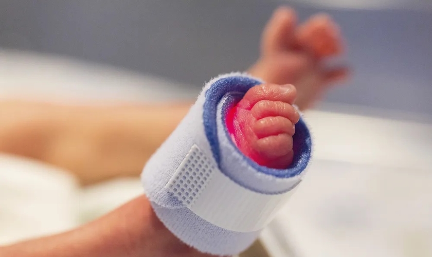 Bebê nascido prematuro. (Foto: Rawpixel/CCO)