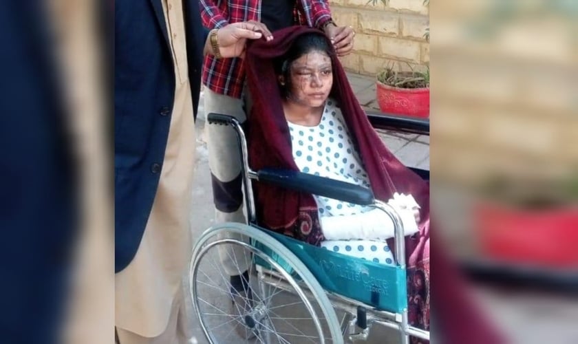 Sunita Masih, de 19 anos, sofreu queimaduras em 20% de seu corpo. (Foto: Morning Star News).