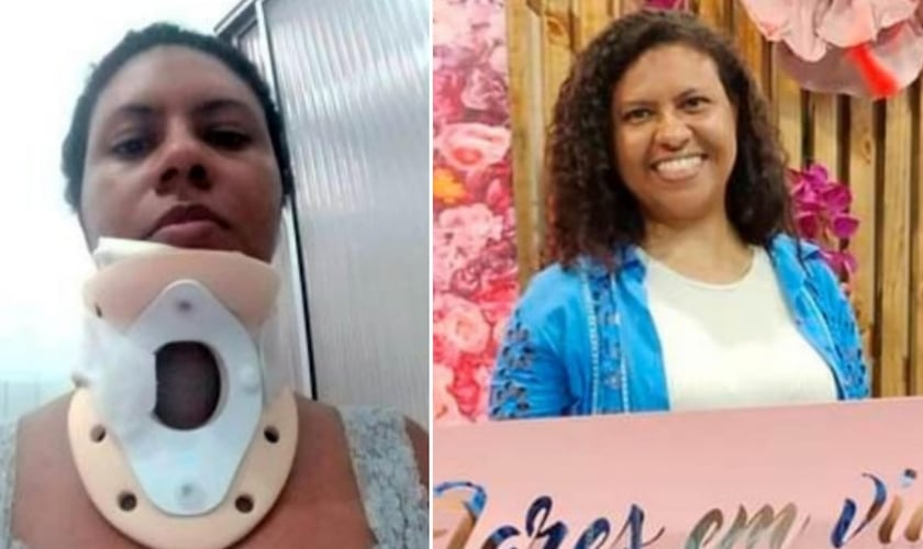 Claudia Lima sofreu um grave acidente. (Foto: Site Mulher Cristã).