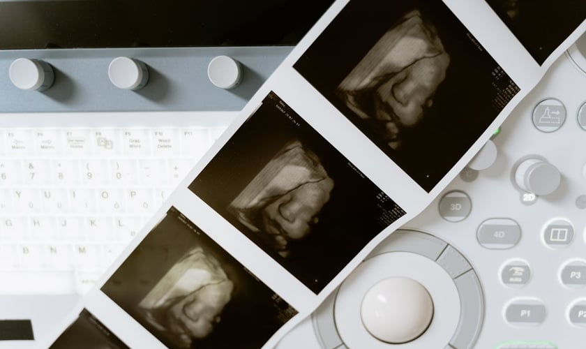 Atualmente, o aborto é permitido até a 24ª semana de gestação. (Foto: Pexels/Mart Production)