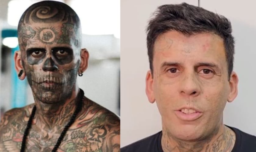 Leandro de Souza passou por mais uma sessão de remoção das tatuagens no rosto. (Foto: Arquivo pessoal/Reprodução/Instagram/Hell Tattoo).