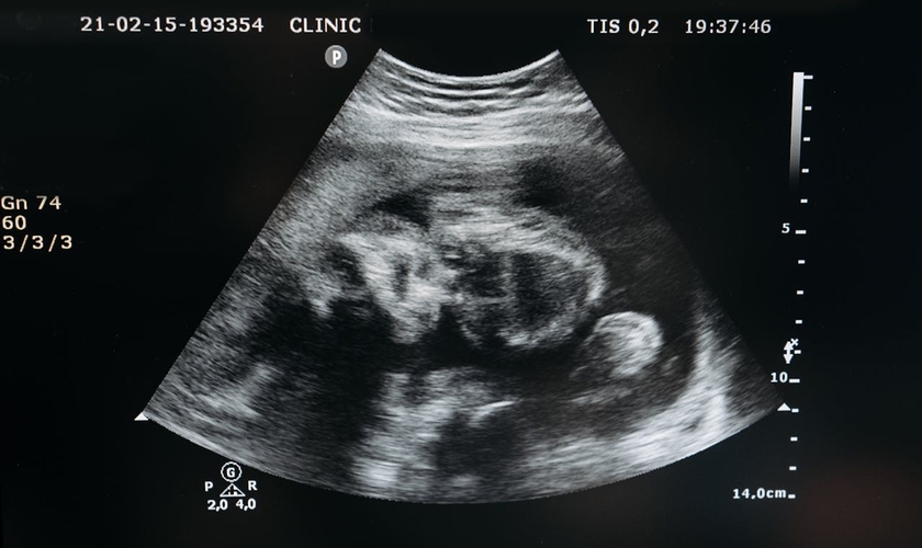 Mudança no Código Civil reconhece personalidade legal ao feto. (Foto: Pavel Danilyuk / Pexels)