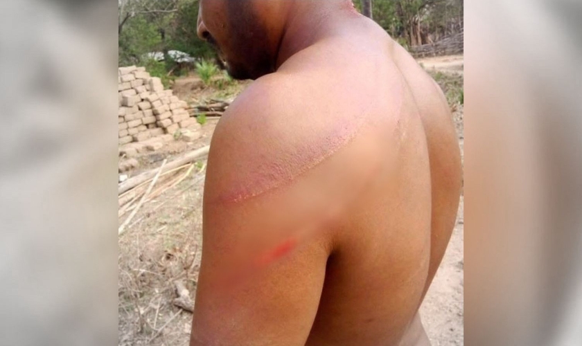 O pastor Motu Sodi após as agressões. (Foto: Reprodução/Morning Star News)