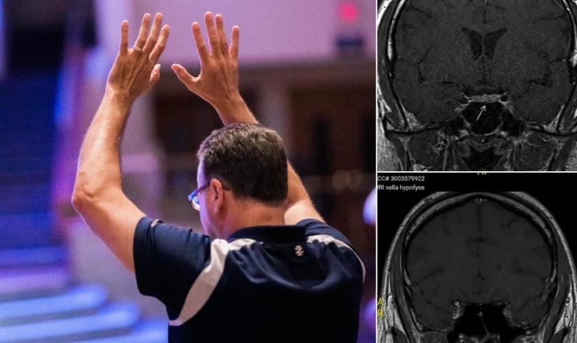 O tumor desapareceu do cérebro do homem no segundo exame. (Foto: Imagem ilustrativa/Unsplash/Jesus Loves Austin/Instagram/Shakersplaces).