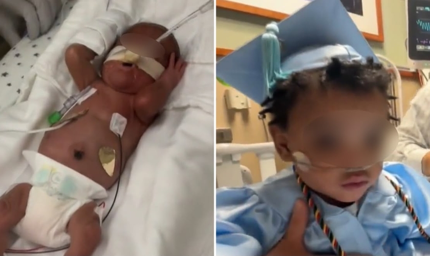 Após 11 meses na UTIN, Adonis recebeu alta. (Foto: Reprodução/CBS News)