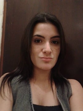 Vitiligo 01 Vitiligo 01