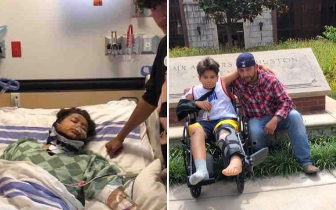 Menino de 11 anos sobrevive milagrosamente após ser atropelado por caminhonete, nos EUA