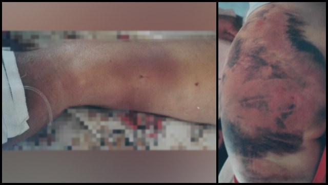 Cristãos mostram marcas de torturas realizadas em prisões comunistas, na China