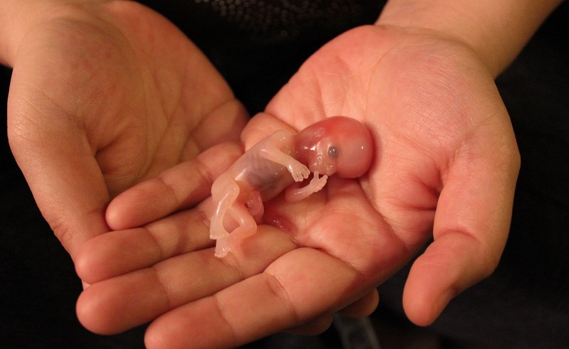 Tailândia poderá autorizar aborto nas primeiras 12 semanas de gravidez