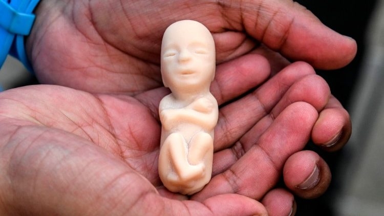 Mais de 62 milhões de abortos foram realizados nos EUA, desde sua legalização