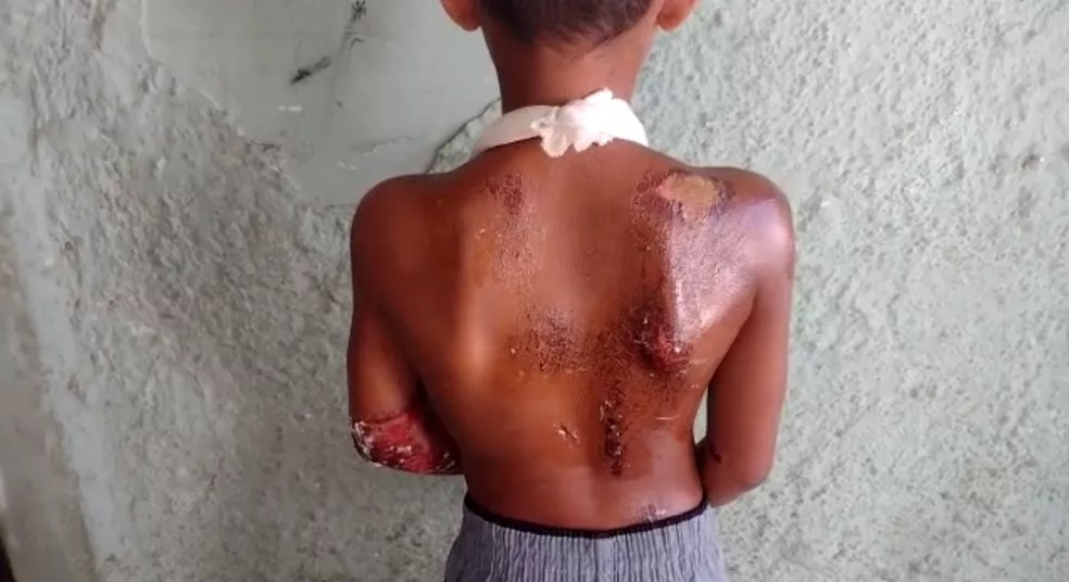 Mãe reconhece milagre após filho ficar embaixo de carro em acidente: 'Deus colocou a mão'