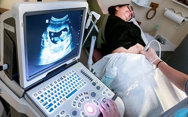 Missão cristã já salvou mais de 90 mil bebês do aborto nos EUA