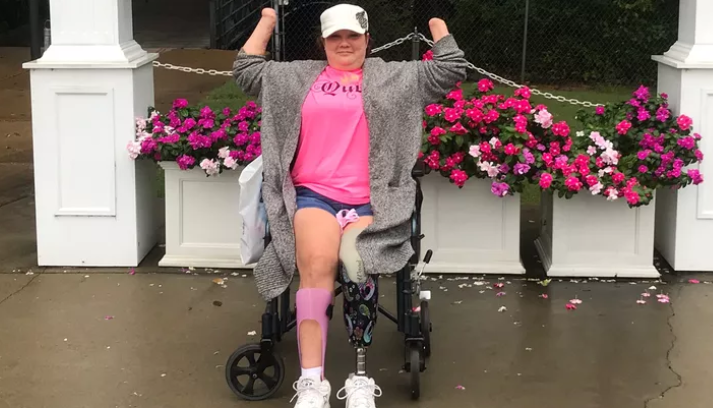  Mulher que amputou pernas e braços diz que Deus ajudou a superar