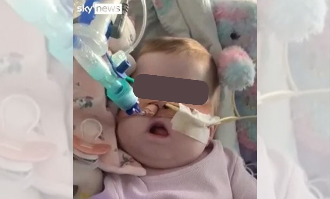 Mesmo após apelo dos pais, bebê tem aparelhos desligados e morre na Inglaterra