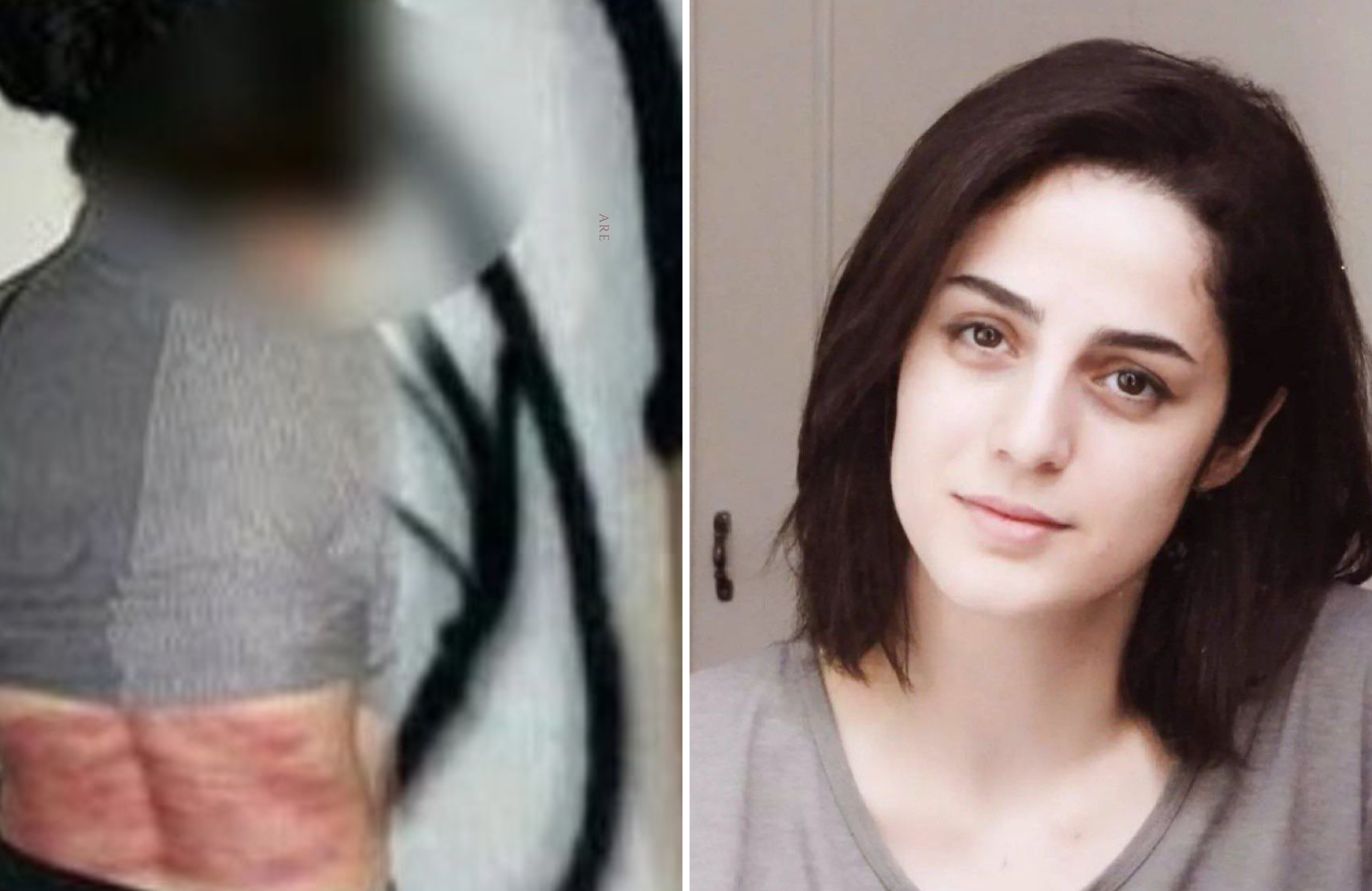 Iraniana é chicoteada 74 vezes por não usar hijab em uma foto