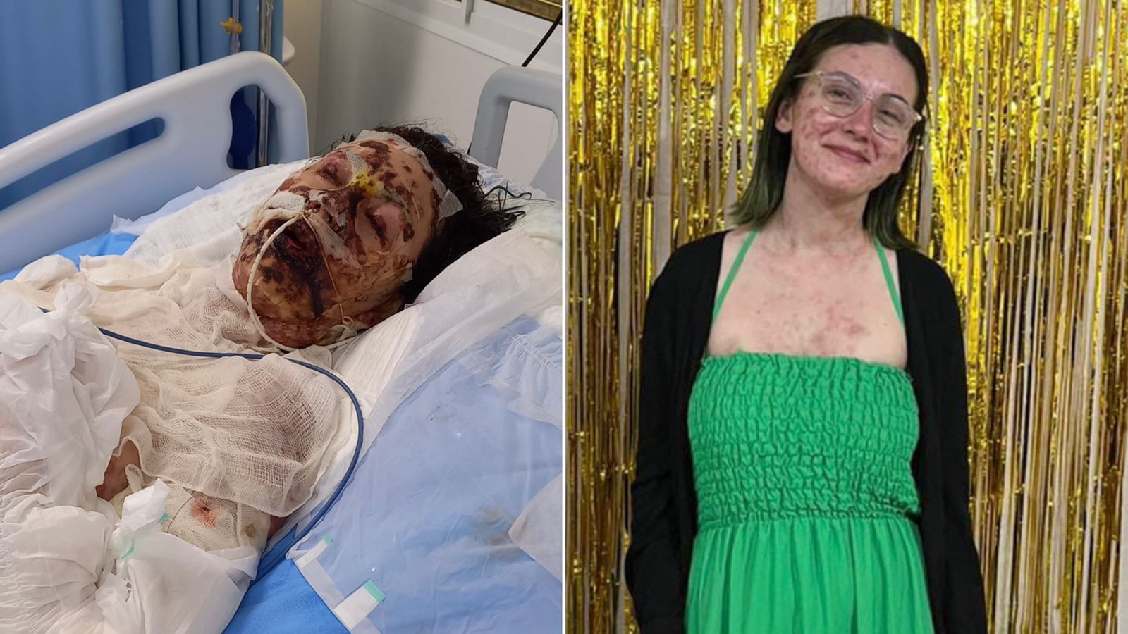 Filha de pastores sobrevive a síndrome rara e diz: “Deus tem um propósito na minha vida”