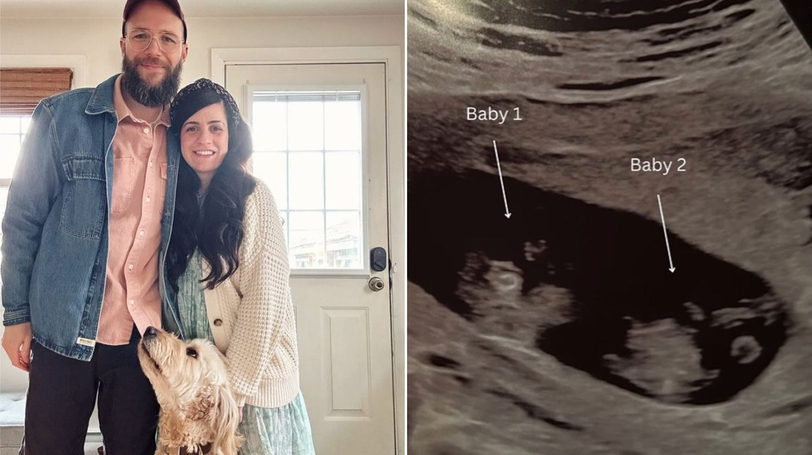 Após abortos espontâneos, casal engravida de gêmeos: “Deus disse que faria”